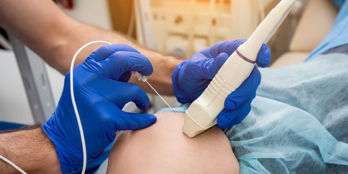 How Much Does a Radiofrequency Ablation Cost?