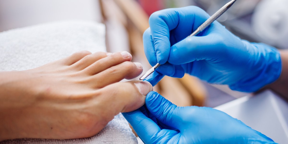 What Do Podiatrists Use To Soften Toenails?