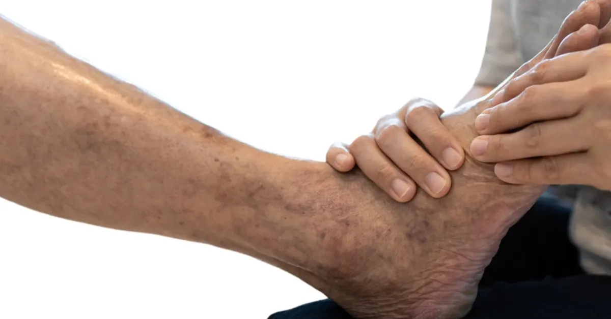 Can Peripheral Artery Disease(PAD) Be Reversed?