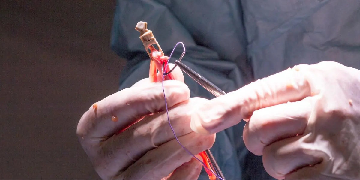 Is Genicular Artery Embolization Safe?