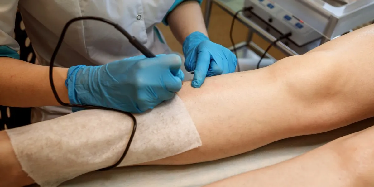 How Much Does Laser Ablation Cost?