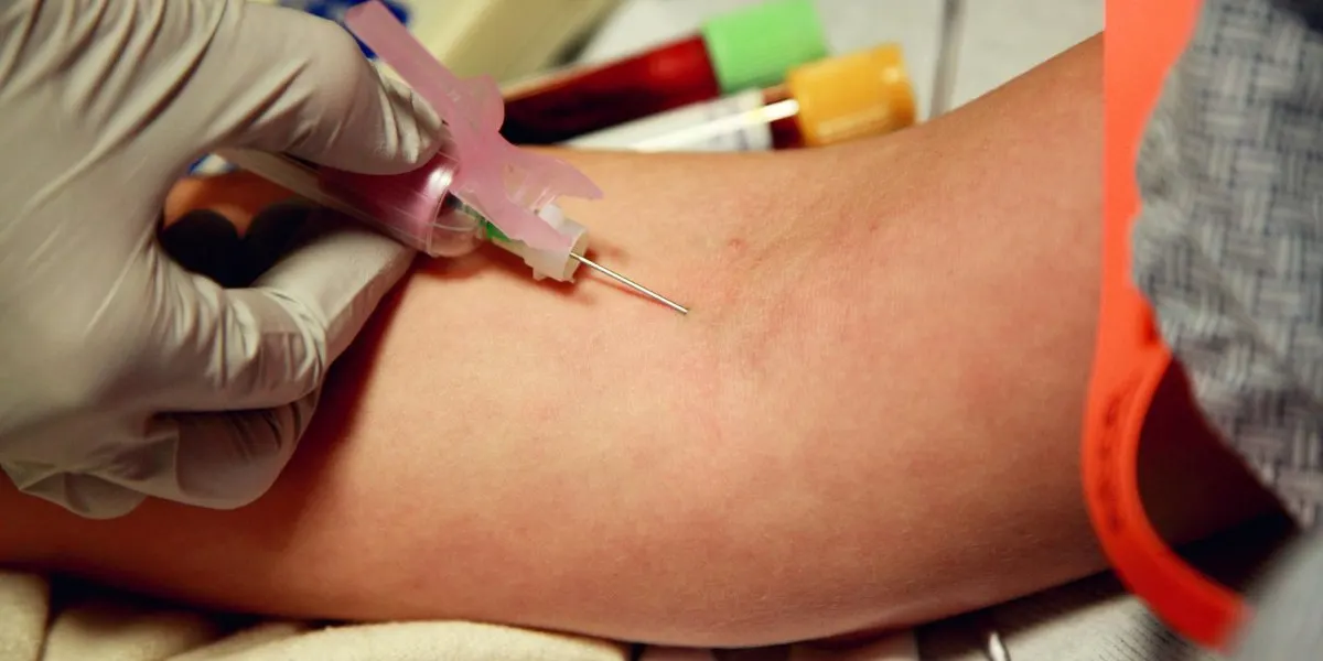 What Test Is Done For Peripheral Artery Disease?