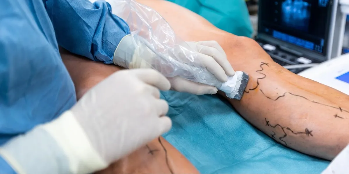 Things To Ask A Vein Doctor Before Your First Visit